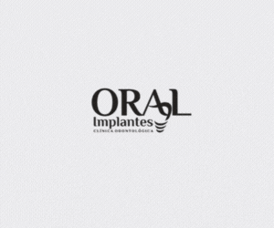 Oral Implante 