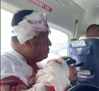 Homem sequestra avião em Belize e é morto por passageiro após pouso.
