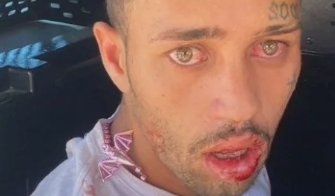 Idoso é esfaqueado por ex-genro durante briga em feira de Rio Doce.