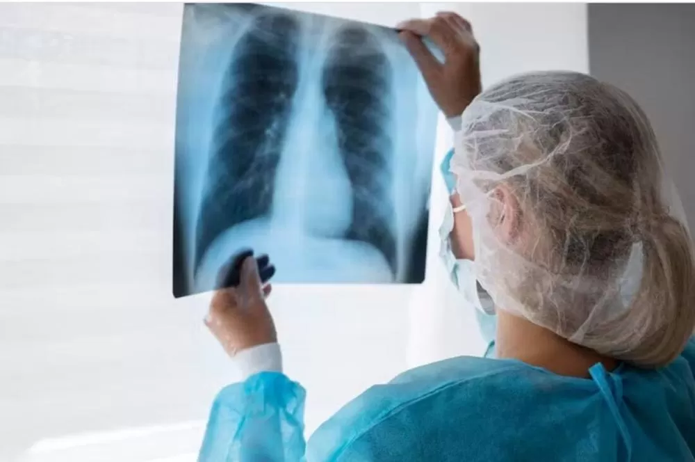 Câncer de pulmão: Hospital de Câncer de Pernambuco dá início à campanha Junho Branco.