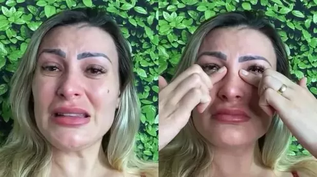 Desespero! Andressa Urach teme ficar cega e faz alerta após procedimento estético radical: “muito arrependida”.