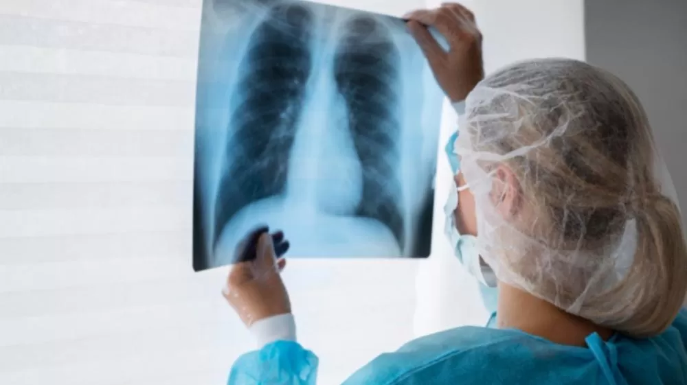 Morador do Arizona morre de peste pneumônica, doença rara transmitida por bactéria