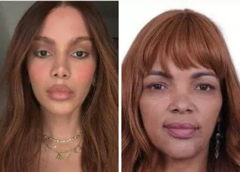 Anitta vira meme após plástica e é comparada a Flordelis: “Não consigo mais ‘desver’”