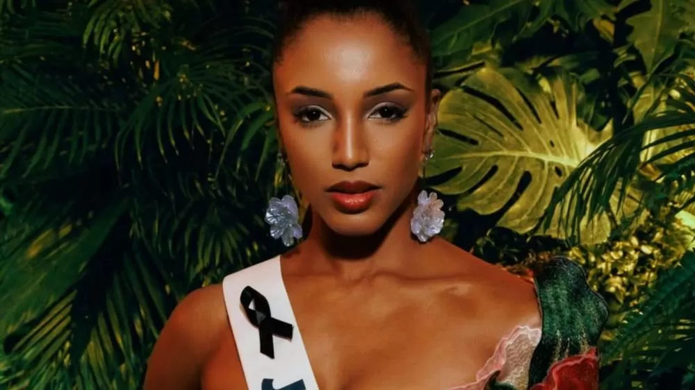 Miss Jamaica está em estado grave na UTI após queda no palco durante desfile