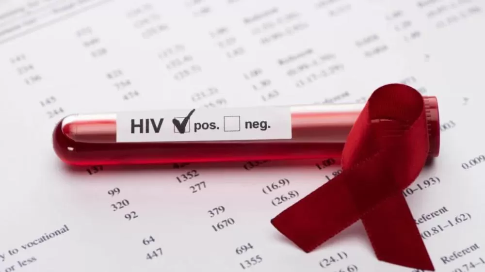 Sétimo paciente no mundo tem remissão do HIV