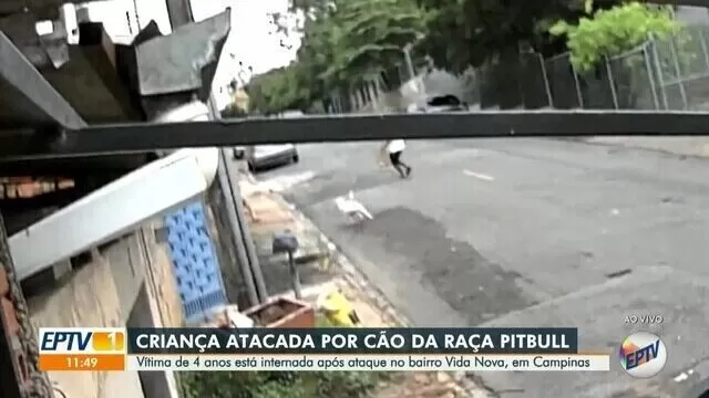 Vídeo! Pitbull foge de casa e ataca menina de 4 anos em SP