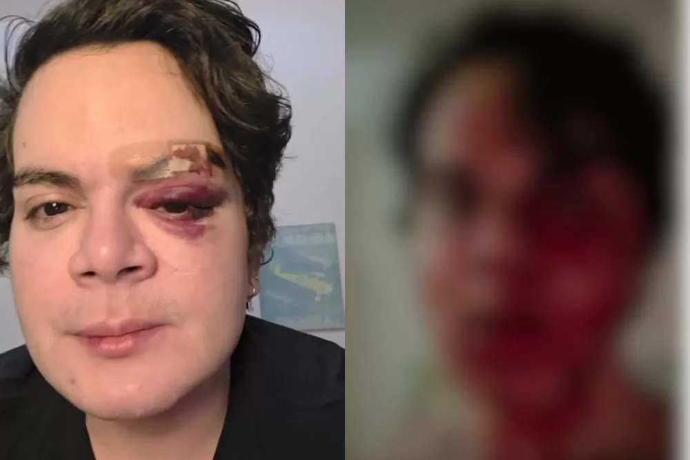 Médico é agredido por vizinho no Recife: Suspeito é solto e defesa nega homofobia.