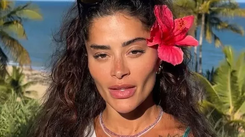 Antes e depois de Aline Campos surpreende internautas; confira