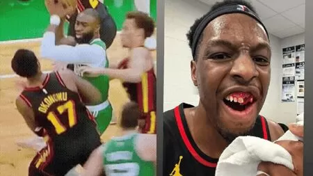 Cotovelada de estrela do Celtics em jogo da NBA faz adversário perder dentes; veja vídeo