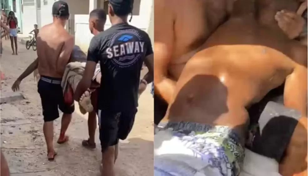 Morre adolescente mordido por tubarão em Olinda: 'Lesão bastante extensa, num local de artérias', diz médico