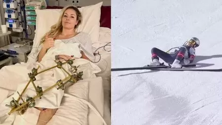 Lindsey Vonn passa por três cirurgias após grave queda de esqui nos Jogos de Inverno