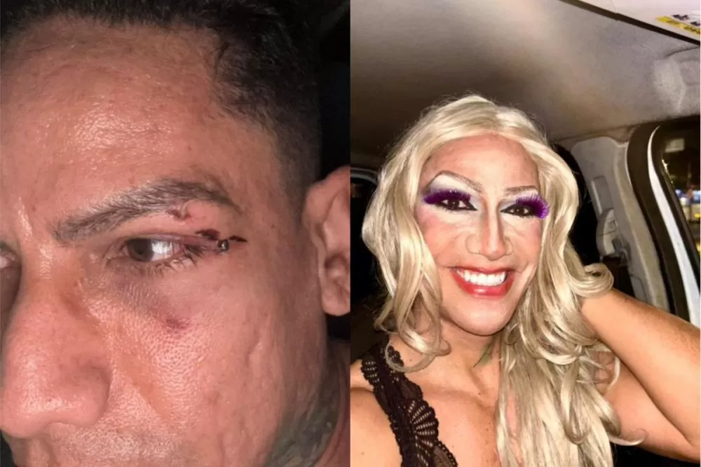 Folião relata agressão homofóbica durante o carnaval em Olinda