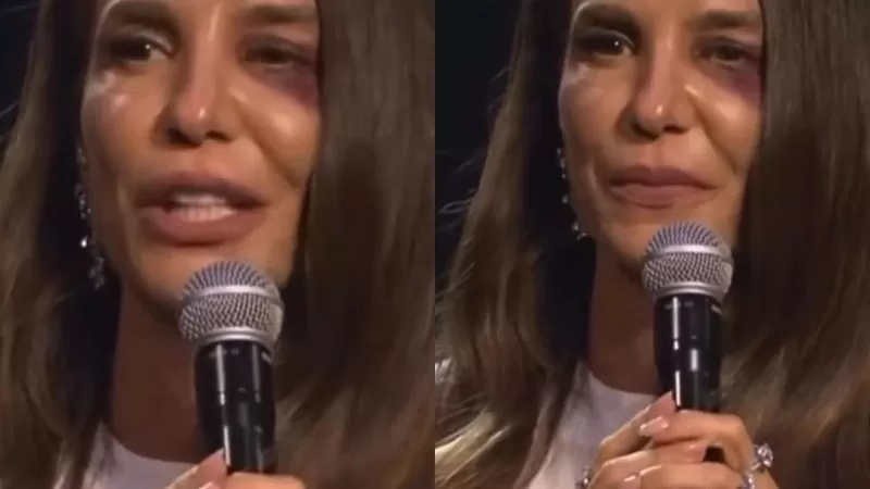Ivete Sangalo passará por cirurgia neste domingo (1); saiba detalhes