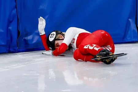 Jogos Olímpicos de Inverno: patinadora atingida por lâmina no rosto mostra cicatriz e relata sequela.