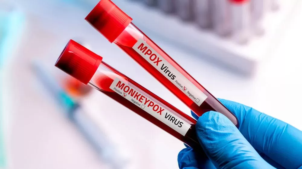 Brasil registra primeiro caso de Mpox por nova cepa do vírus, confirma Ministério da Saúde.