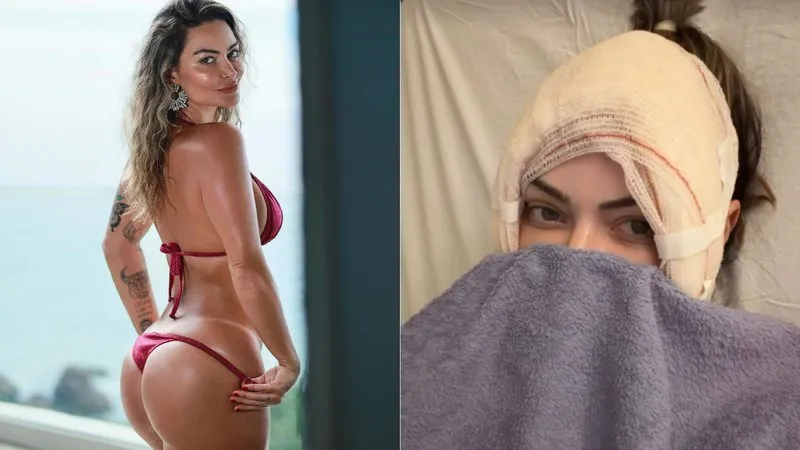 Criadora de conteúdo adulto revela cirurgia íntima e exibe resultado de procedimentos: “Minha periquita está linda”