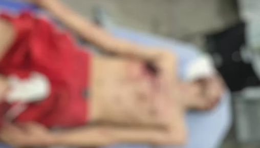 Confronto em Taquaritinga do Norte termina com assaltante morto após troca de tiros com a polícia.